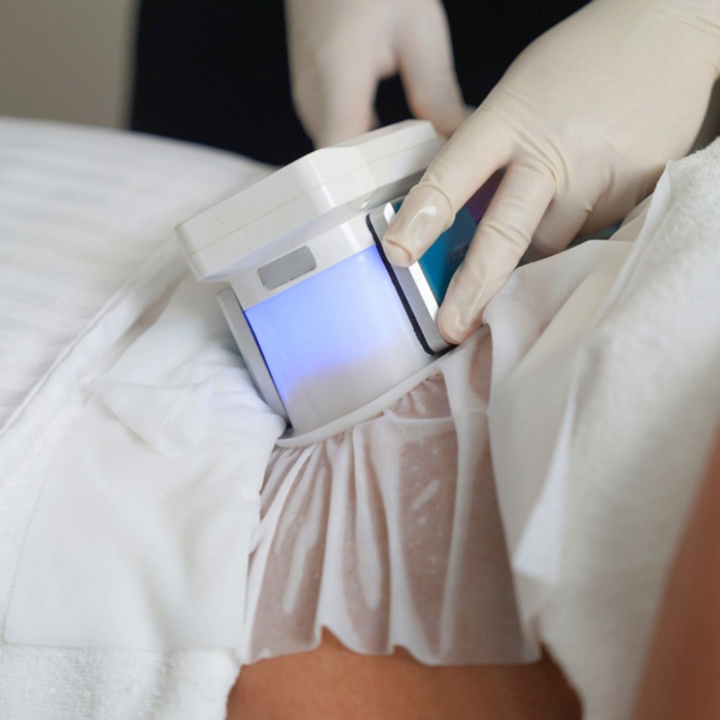 Image for service: Cryolipolise - Vetbevriezing